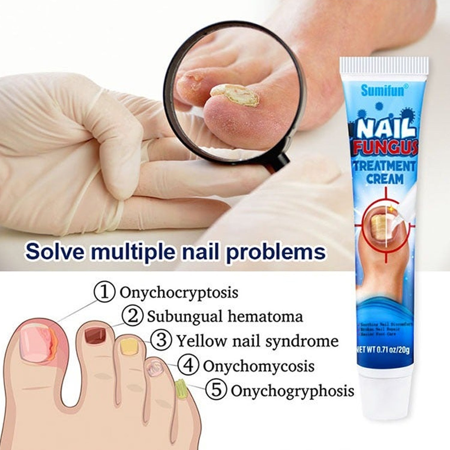 Sumifun Nail Fungus Care Cream - 20g Sumifun Nail Fungus Care Cream - 20g
