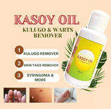 Kasoy Oil by Angel Touch - 60ml