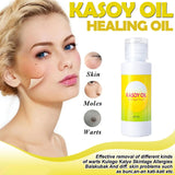 Kasoy Oil by Angel Touch - 60ml