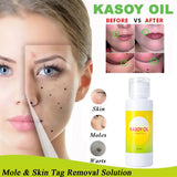 Kasoy Oil by Angel Touch - 60ml