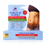 Alatar Original Stretch Marks Removal - 50g