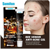 Sumifun Bee Venom Anti-Acne Gel - 20g