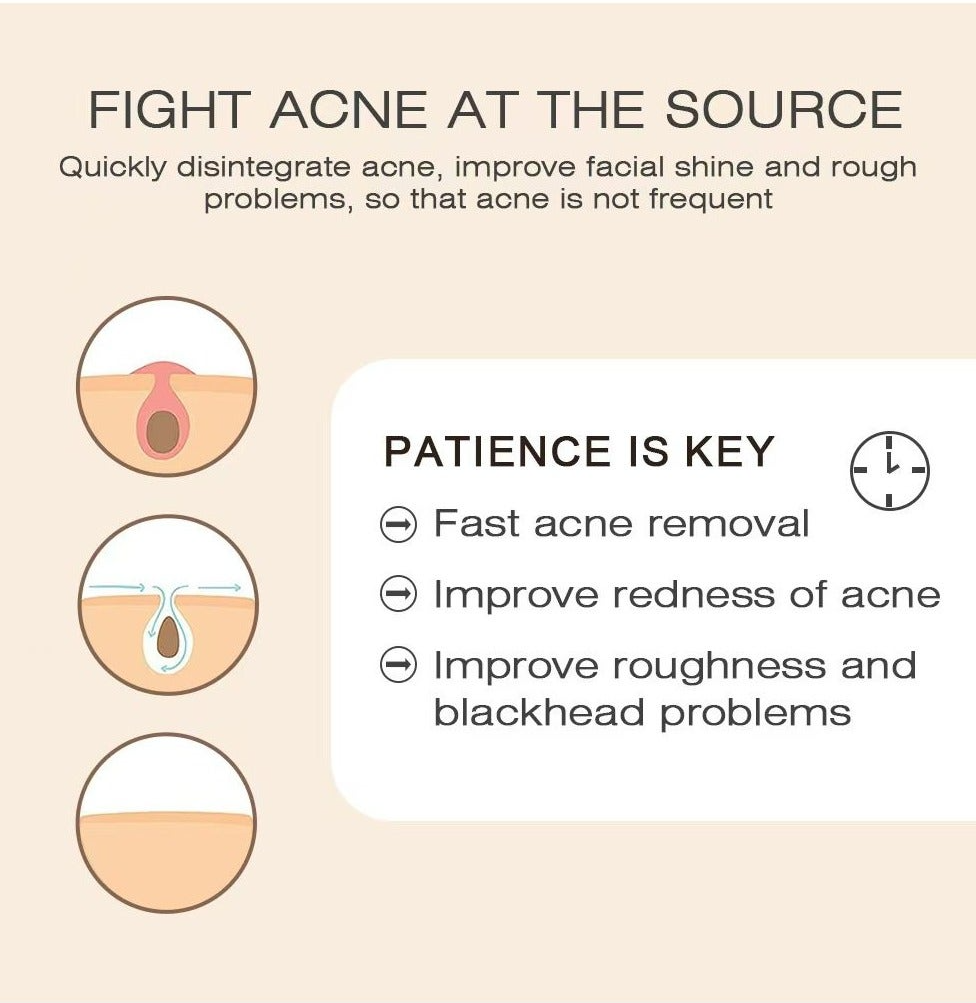 Sumifun Bee Venom Anti-Acne Gel - 20g Sumifun Bee Venom Anti-Acne Gel - 20g