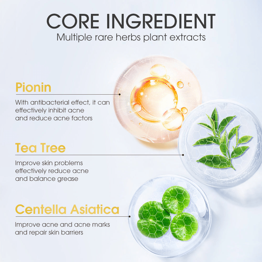 Skinever Salicylic Acid Acne Treatment Ice Sleep Masque - 75ml Skinever Salicylic Acid Acne Treatment Ice Sleep Masque - 75ml