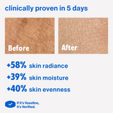 Vaseline Gluta-Hya Serum Burst Lotion Dewy Radiance 70X - 300ml