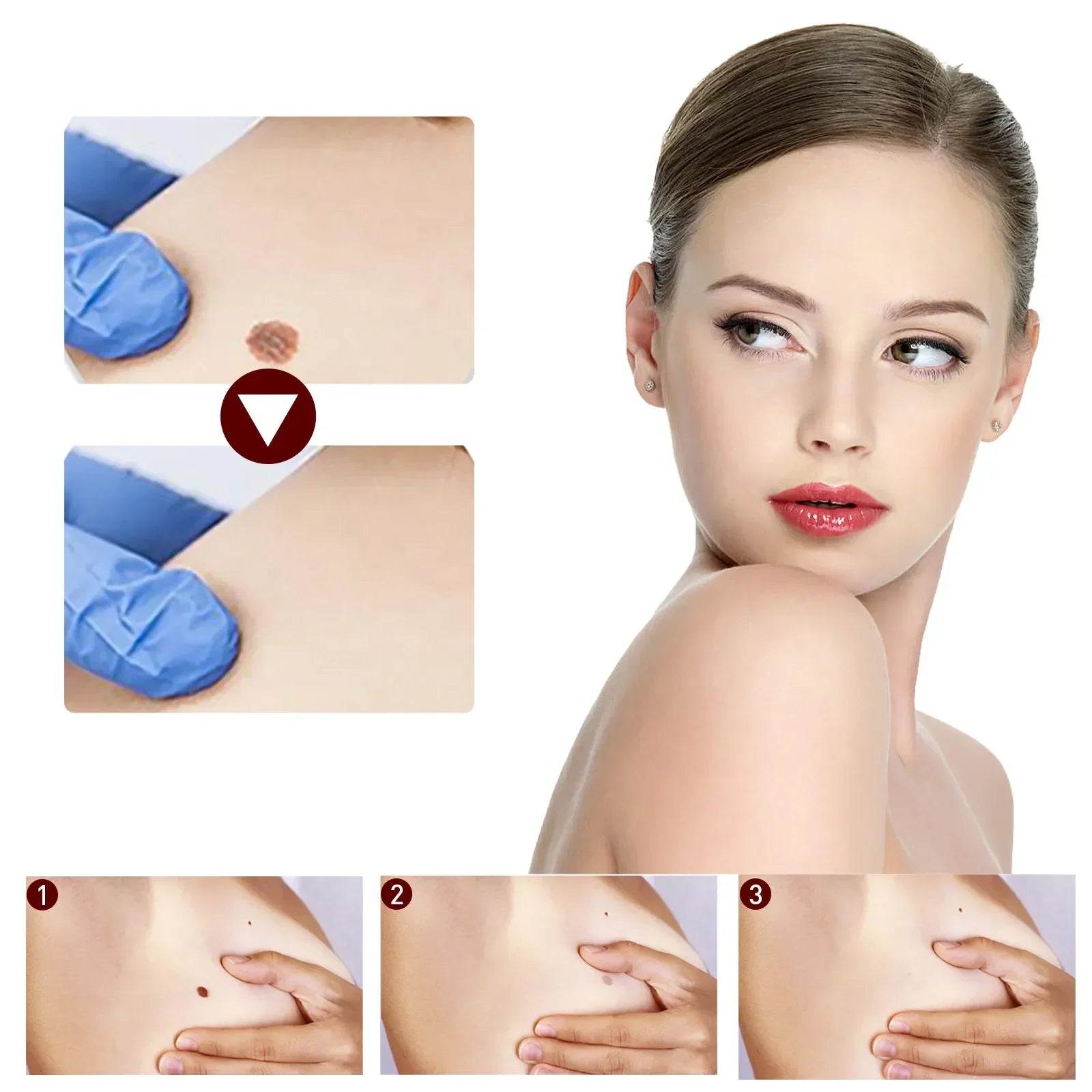 Jaysuing Liquid Warts Flat Eliminate - 3ml Jaysuing Liquid Warts Flat Eliminate - 3ml