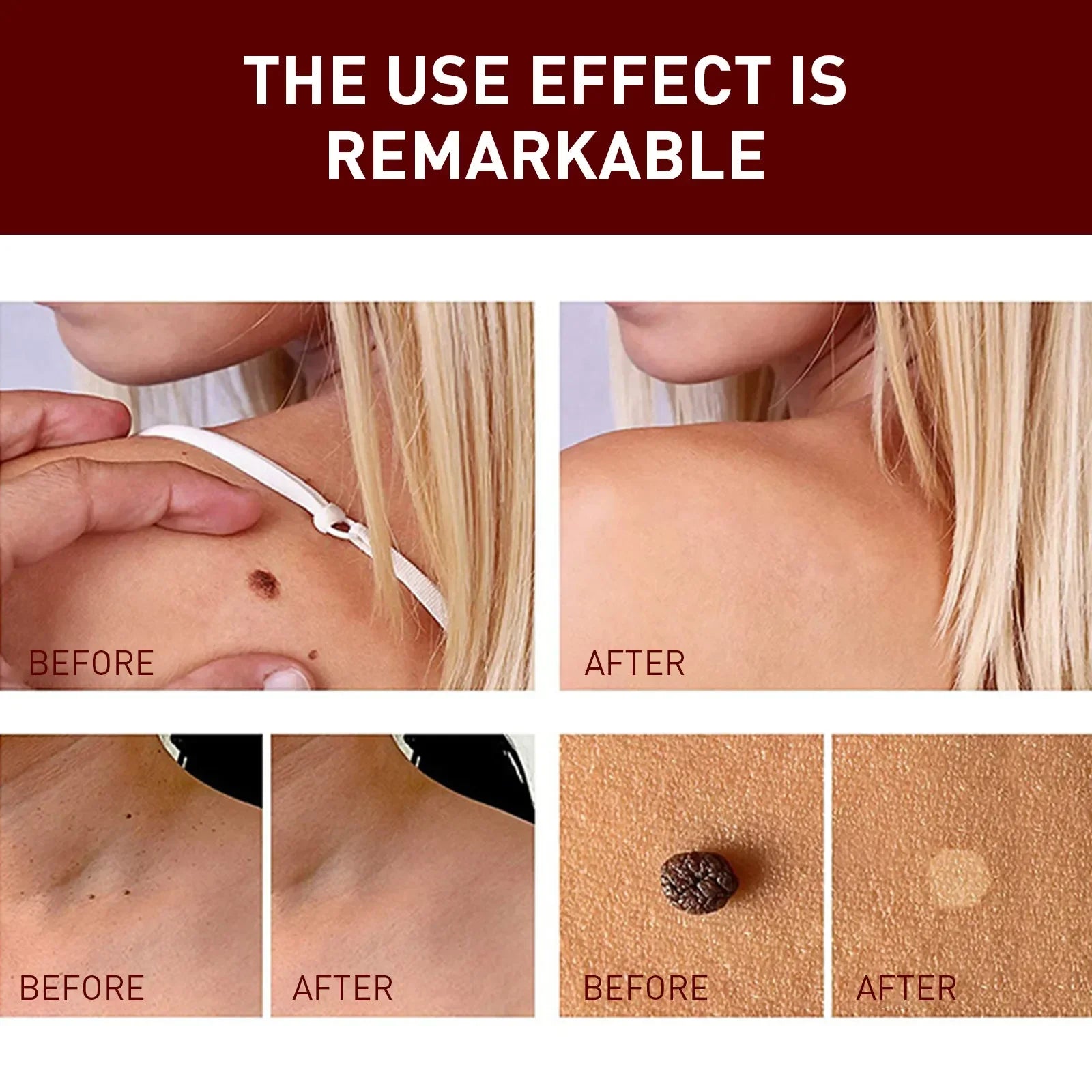 Jaysuing Liquid Warts Flat Eliminate - 3ml Jaysuing Liquid Warts Flat Eliminate - 3ml