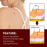 Jaysuing Liquid Warts Flat Eliminate - 3ml