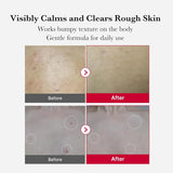 Medicube Red Acne Body Peeling Shot - 110g