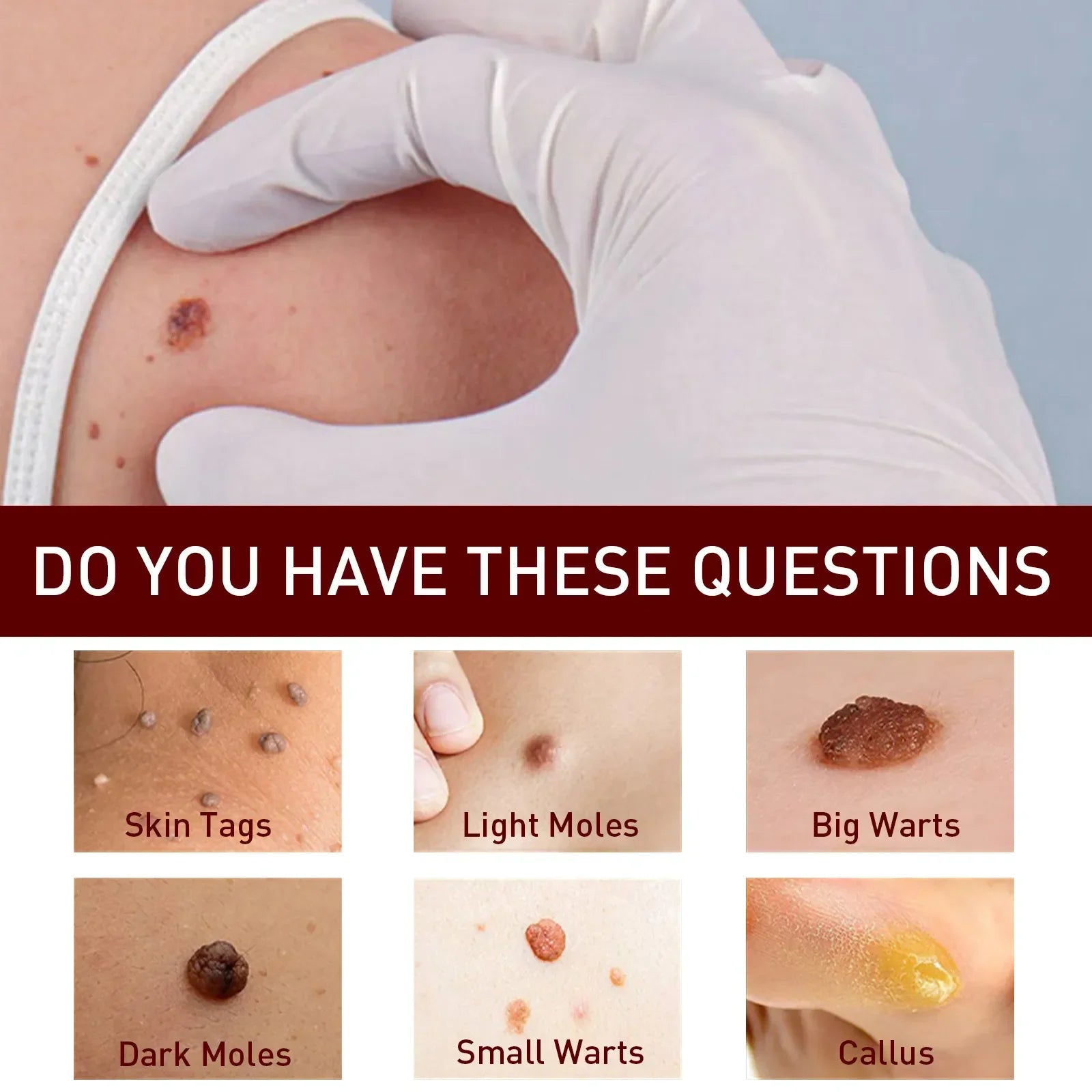 Jaysuing Liquid Warts Flat Eliminate - 3ml Jaysuing Liquid Warts Flat Eliminate - 3ml