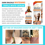 Dr. Davey Dark Knuckle Brightening Serum - 50ml