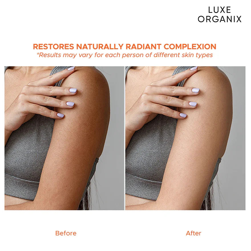 Luxe Organix Niacinamide + Tranexamic Acid Youthful Glow Serum Lotion - 200ml Luxe Organix Niacinamide + Tranexamic Acid Youthful Glow Serum Lotion - 200ml