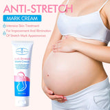 Aichun Beauty Anti-Stretch Mark Cream - 100g