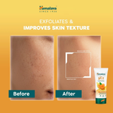 Himalaya Dark Spot Clearing Turmeric Face Mask - 100ml