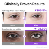 Numbuzin No.9 NMN Collagen Under Eye Patches - 8g × 5 Pairs