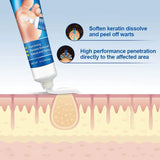 Sumifun Wart Remover Cream - 20g