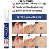 مزيل الثآليل والعلامات الندبية فائق القوة من دكتور ديفي - ١٦ مل