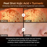 Dr.Melaxin Peel Shot Exfoliating Kojic Acid Turmeric Serum - 80ml