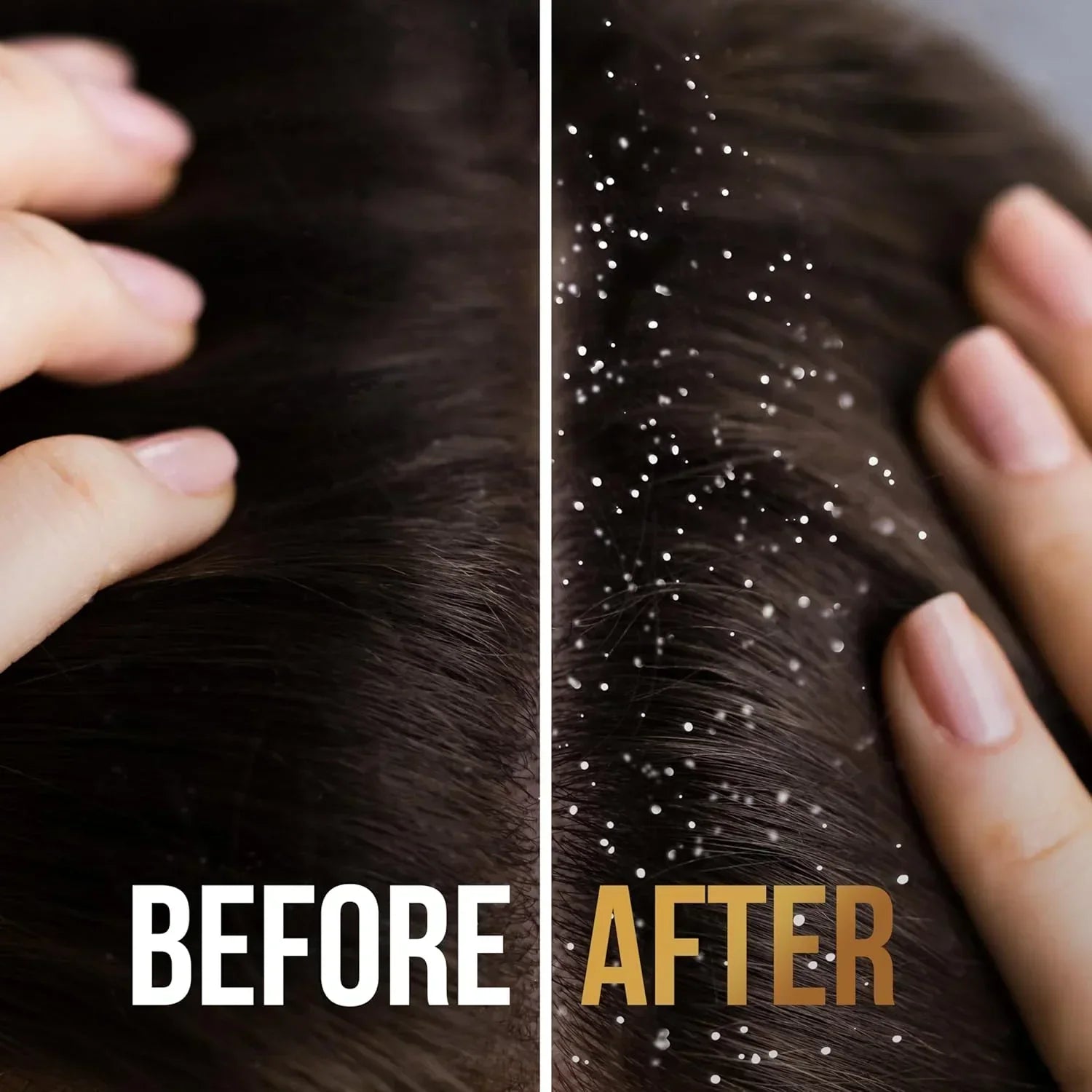 Pantene Pro-V Anti-Dandruff 2 in 1 Shampoo + Conditioner - 400ml Pantene Pro-V Anti-Dandruff 2 in 1 Shampoo + Conditioner - 400ml