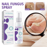 Jaysuing Nail Fungus Spray - 100ml