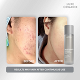 Luxe Organix Brightening Repair Ultra Light Glow Toner - 150ml