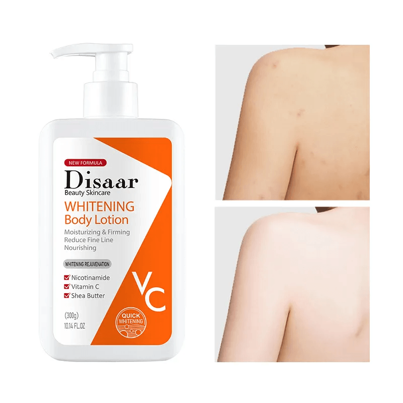 لوشن ديزار لتبييض الجسم بالنيكوتيناميد وفيتامين سي - 300 جرام لوشن ديزار لتبييض الجسم بالنيكوتيناميد وفيتامين سي - 300 جرام