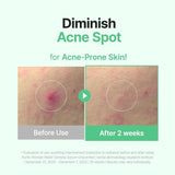 Purito Wonder Releaf Centella Serum Unscented - 60ml