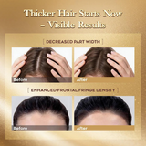 Lumei Rosemary Infused Hair Growth Serum - 30ml