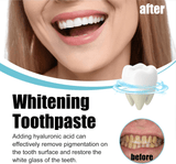 Scoban Teeth Brightening Toothpaste With Baking Soda - 200g
