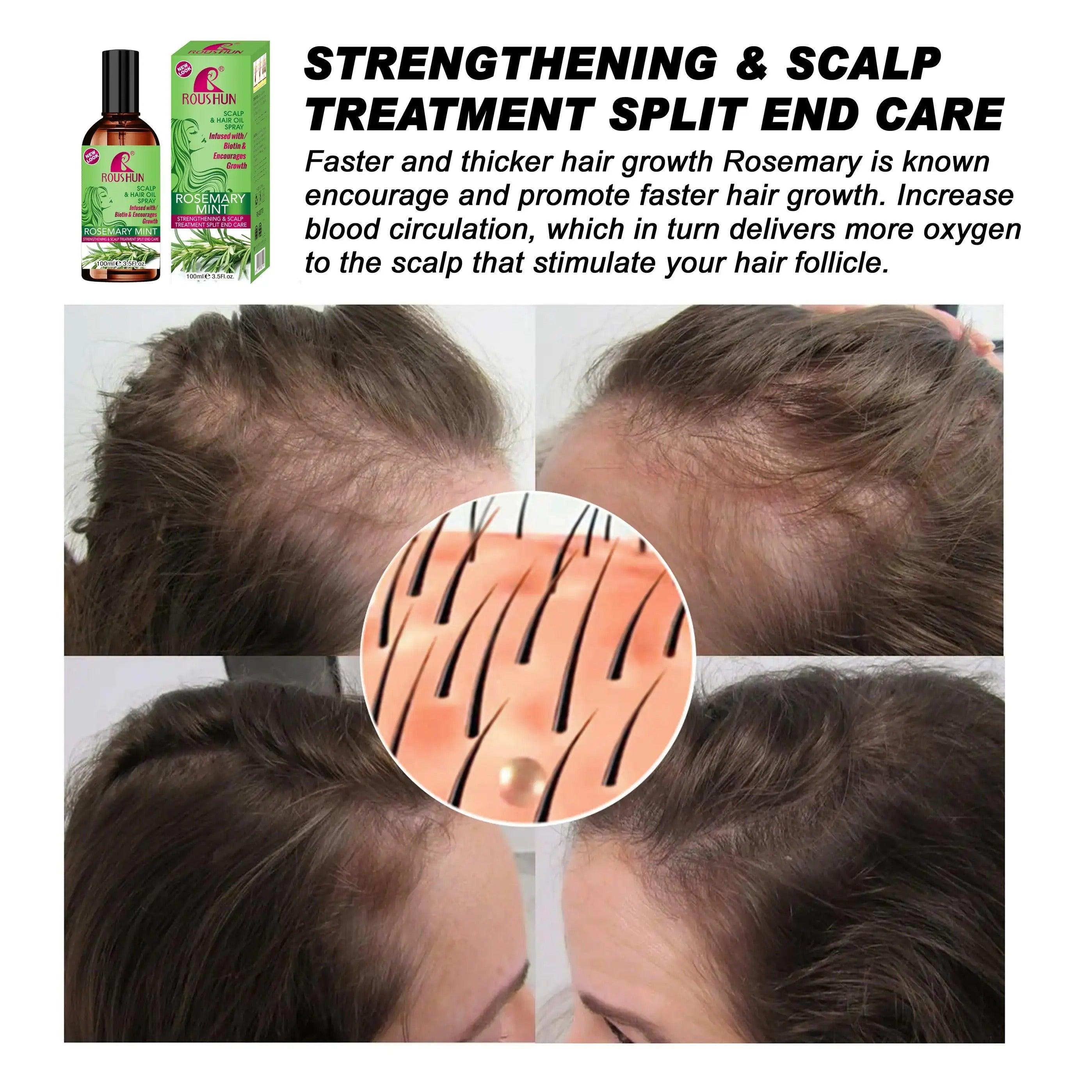 بخاخ زيت نمو الشعر بالروزماري والنعناع من روشون - 100 مل بخاخ زيت نمو الشعر بالروزماري والنعناع من روشون - 100 مل