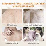 Quarxery Mite & Acne Cleansing Body Wash - 250ml