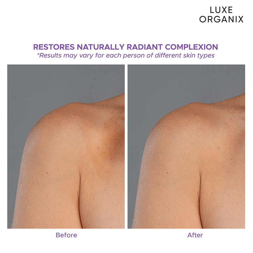 Luxe Organix Retinol + Gluta Youthful Radiance Brightening Serum Lotion - 350ml Luxe Organix Retinol + Gluta Youthful Radiance Brightening Serum Lotion - 350ml