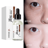 مصل الوجه المضاد للنمش من نيكوتيناميد من هيميز - 30 مل