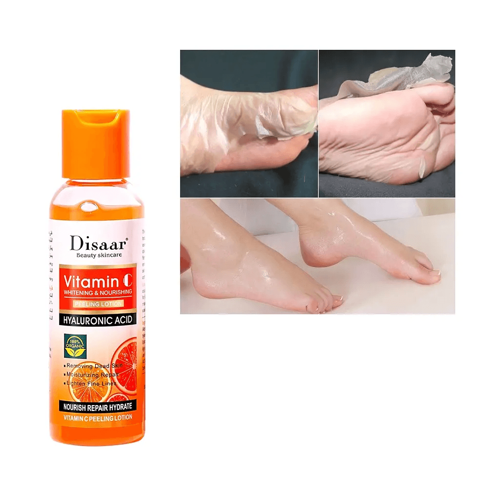 لوشن تقشير فيتامين سي وحمض الهيالورونيك من ديسار - 100 جرام لوشن تقشير فيتامين سي وحمض الهيالورونيك من ديسار - 100 جرام