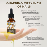 Guanjing Nail Care Ginger Oil Improve Damaged Nails - 30ml