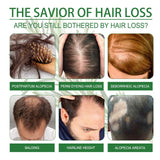 ماء إيلهو إكليل الجبل يمنع تساقط الشعر - 30 مل