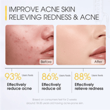 Skinever Salicylic Acid Acne Treatment Ice Sleep Masque - 75ml