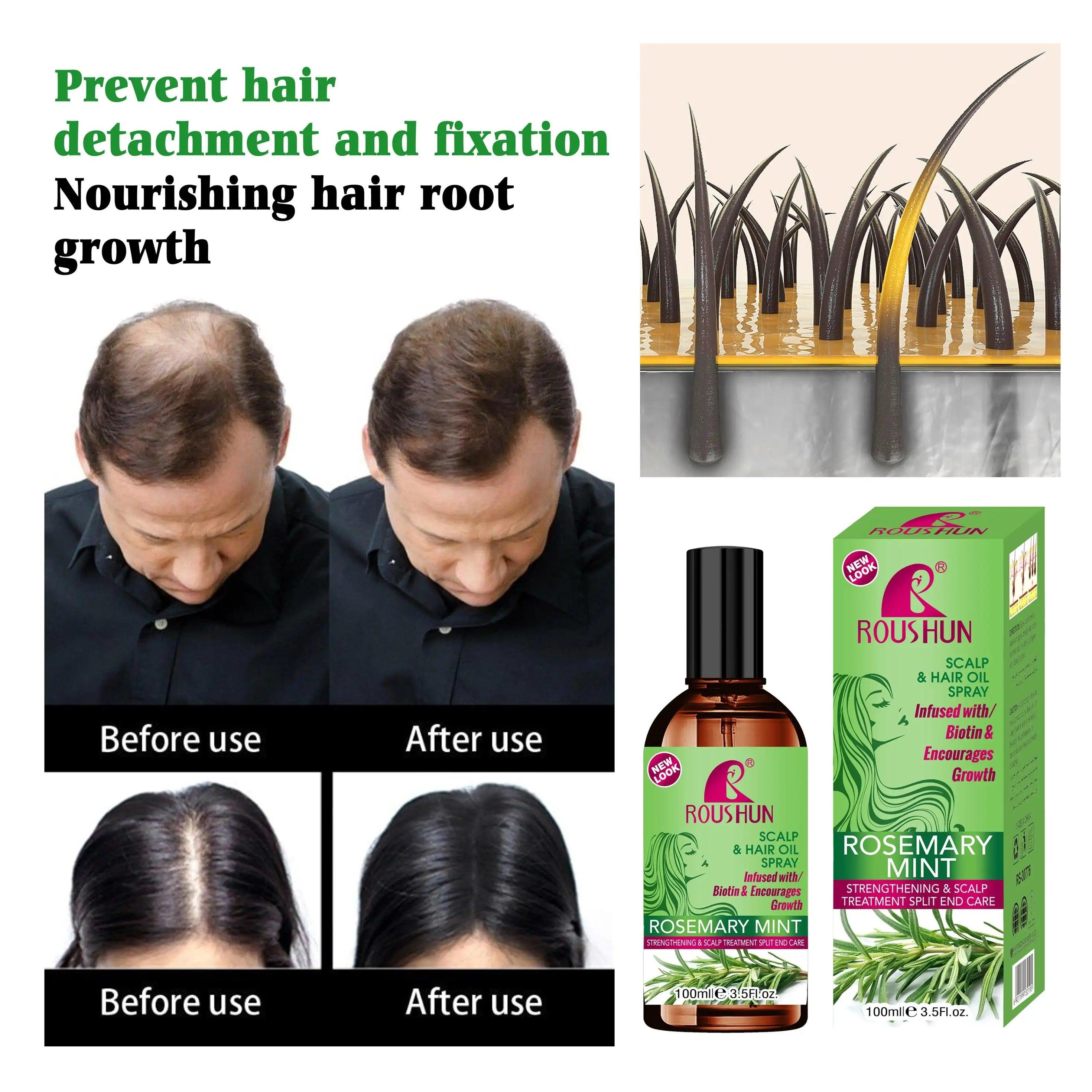 بخاخ زيت نمو الشعر بالروزماري والنعناع من روشون - 100 مل بخاخ زيت نمو الشعر بالروزماري والنعناع من روشون - 100 مل