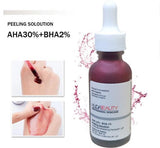 Huda Beauty AHA 30%+BHA 2% Peeling Solution - Pinoyhyper