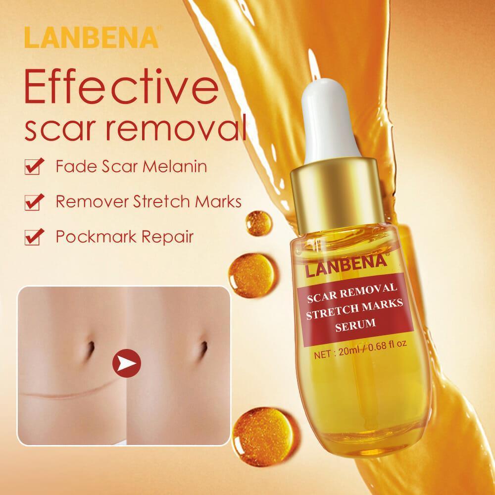 Lanbena Scar and Stretch Mark Removal Serum - 20 ml - Pinoyhyper Lanbena Scar and Stretch Mark Removal Serum - 20 ml - Pinoyhyper