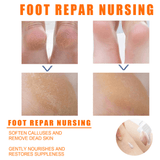 Orange Oil Foot Peeling Spray - 110ml - Pinoyhyper