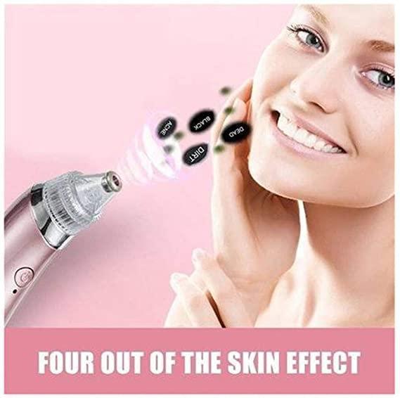 Portable Ultrasonic XN-8030 Electric Blackhead Vacuum Cleaner - Pinoyhyper