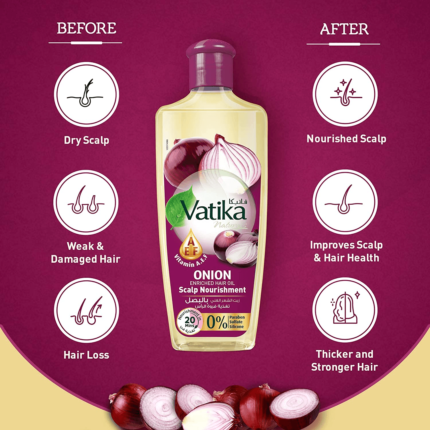 Vatika Naturals Onion Enriched Hair Oil - 300ml - Pinoyhyper Vatika Naturals Onion Enriched Hair Oil - 300ml - Pinoyhyper