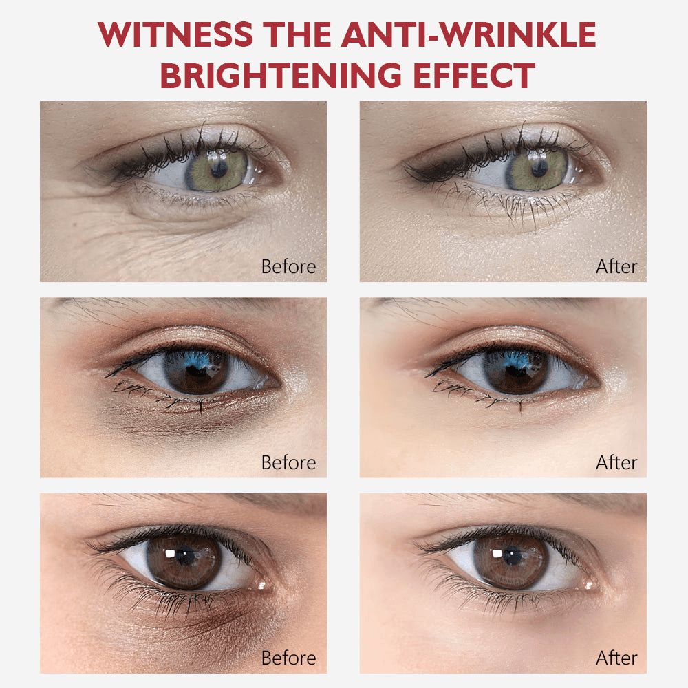 Vibrant Glamour Anti-Aging Retinol Eye Cream - 20g - Pinoyhyper Vibrant Glamour Anti-Aging Retinol Eye Cream - 20g - Pinoyhyper