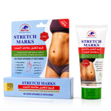 Alatar Original Stretch Marks Removal - 50g