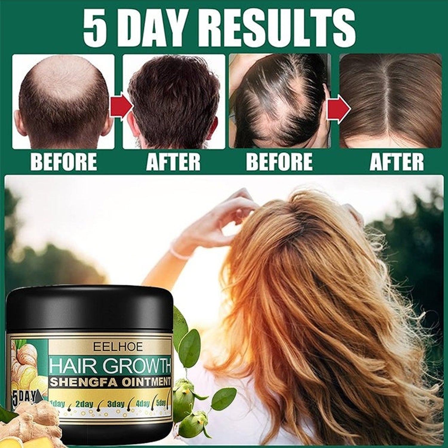 EELHOE Hair Growth Shengfa Cream - 100g