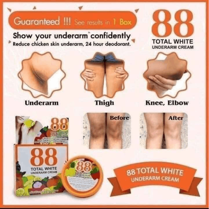 88 Total White Underarm Cream - 35g - Pinoyhyper