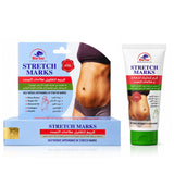 Alatar Original Stretch Marks Removal - 50g