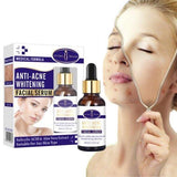 Anti-Acne Whitening Facial Serum 30ml - Aichun Beauty - Pinoyhyper