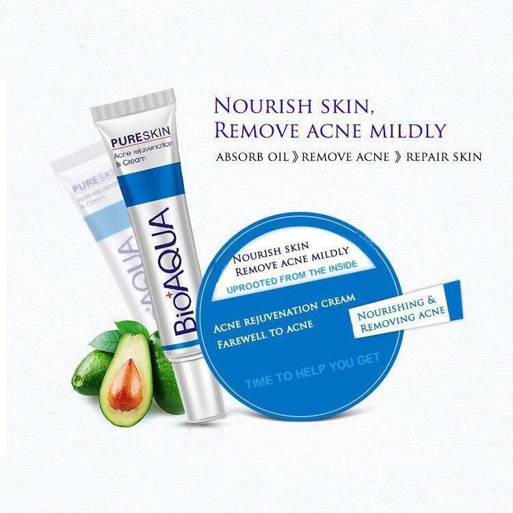 Bioaqua face cream skin care anti acne treatment cream 30g -100% ORIGINAL - Pinoyhyper